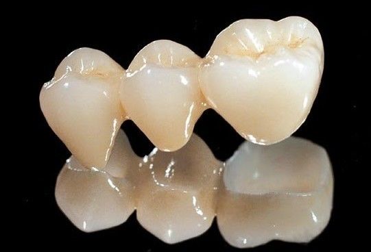 Toute la couronne dentaire de zircone en céramique