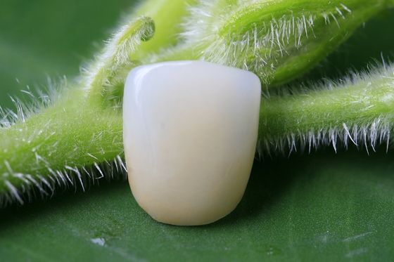 Pleine EMAX couronne dentaire biocompatible en céramique de la grande forme physique