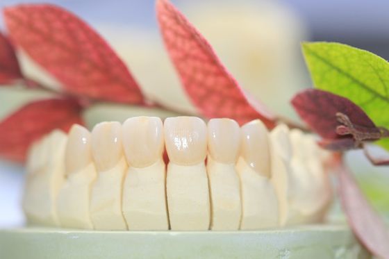 Le laboratoire dentaire a fixé la prosthétique a posé la couronne dentaire de zircone pour Front Teeth