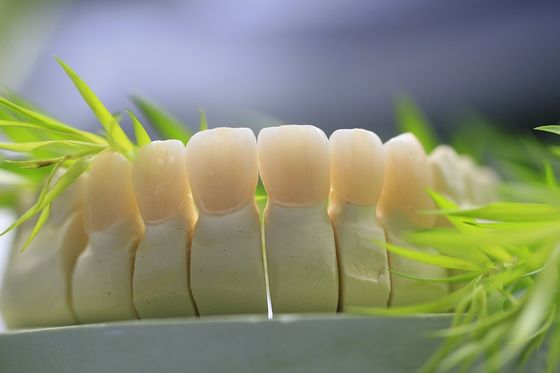 Le laboratoire dentaire a fixé la prosthétique a posé la couronne dentaire de zircone pour Front Teeth
