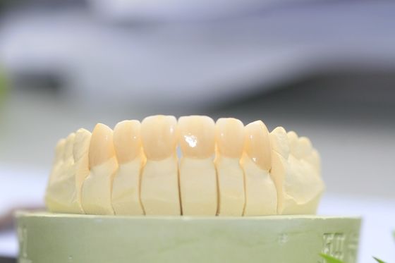 Couronne dentaire de grande de Biocompatibility pleine zircone de découpe pour le laboratoire dentaire