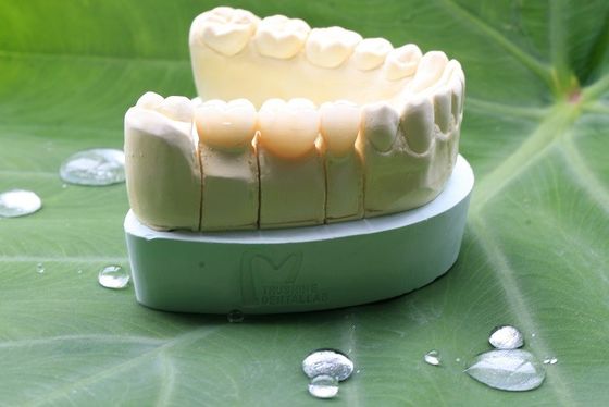 Couronne dentaire de grande de Biocompatibility pleine zircone de découpe pour le laboratoire dentaire