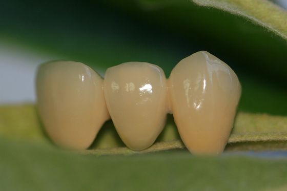 Couronne dentaire de conception zircone ISO13485 en céramique dentaire de laboratoire de la pleine pour les dents antérieures
