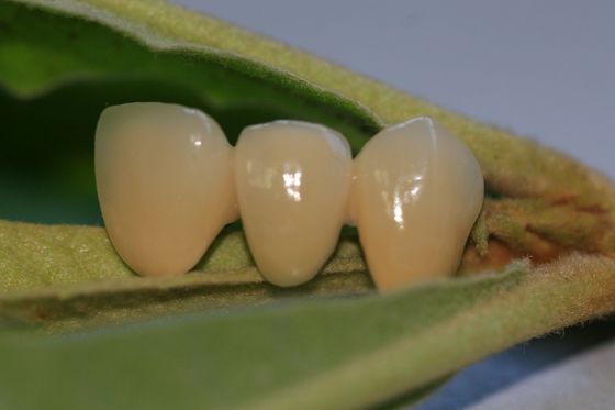 Couronne provisoire composée de couleur naturelle de résine pour les dents antérieures