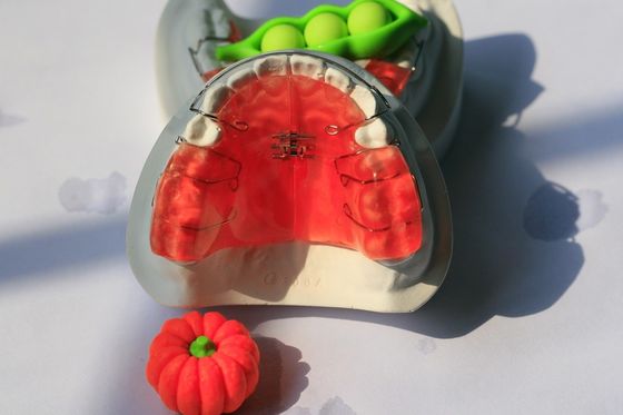 Appareil dentaire orthodontique d'art dentaire fait sur commande d'entretien