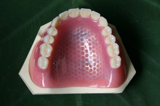 3D imprimant le cadre partiel en métal de dentier de squelette en métal