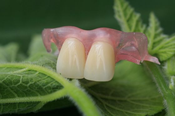 Dentier invisible flexible