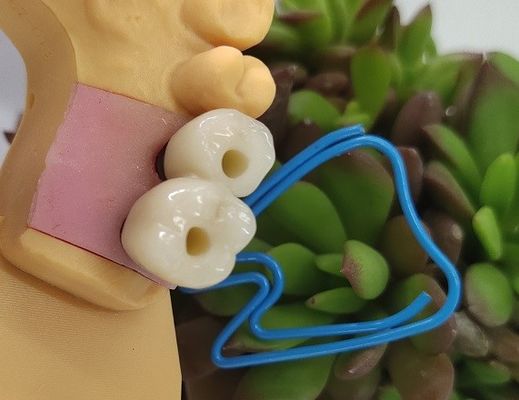 Les implants dentaires d'Endosseous couronnent