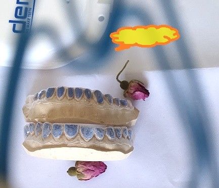 ISO13485 blanchiment fait sur commande Tray For Whitening Teeth