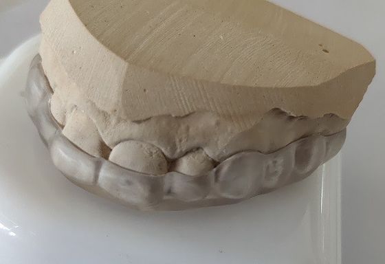 L'esthétique abaisse le morceau de bouche de voûte pour le serrage de dents