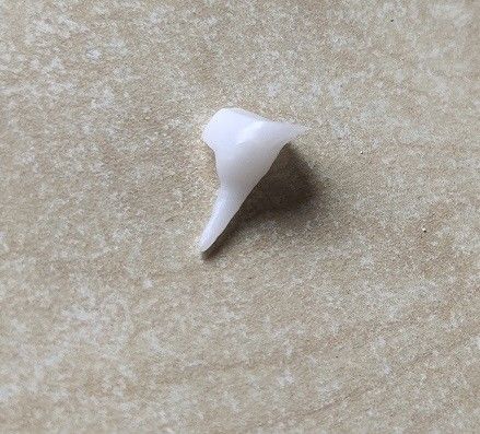 Renforçant la porcelaine Pin Core dentaire d'EMAX