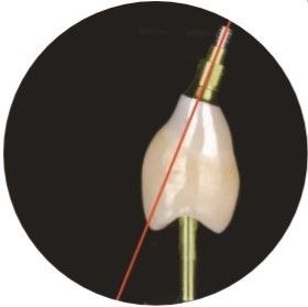 L'ASC naturel a pêché la Manche de vis les implants que dentaires couronnent