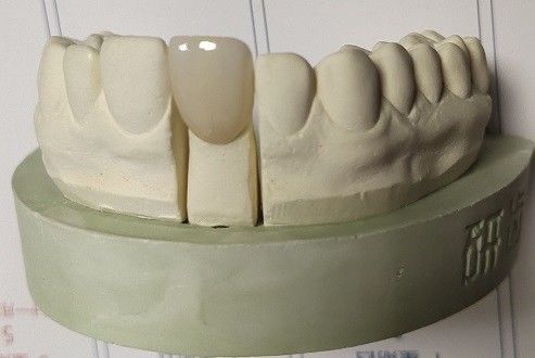 La zircone bloque la copie 3D dentaire par le fraisage du DAO FAO
