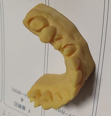 Haut modèle dentaire de l'impression 3D de la précision ISO13485 Trushine