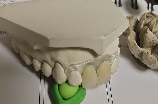Dentier invisible mou et élastique provisoire de Valplast