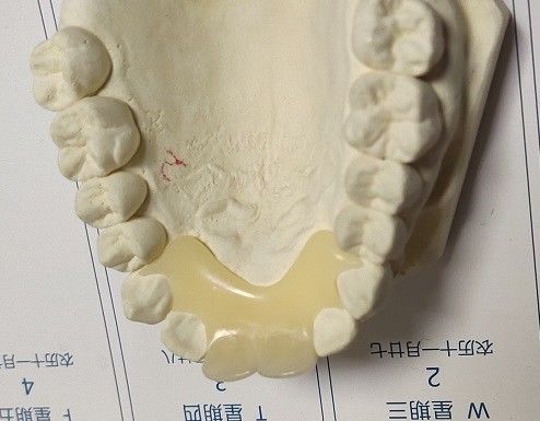 Dentier invisible en nylon élastique mou de Trushine