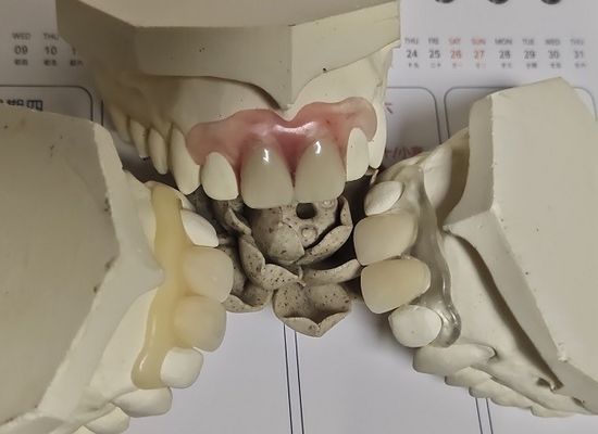 Dentier invisible mou confortable de l'ajustement ISO13485 RPD
