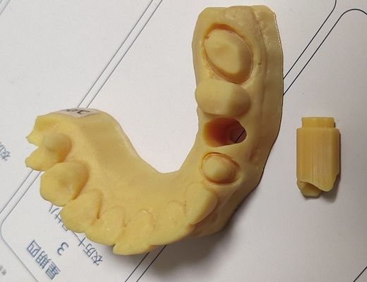 Haut modèle dentaire de l'impression 3D de la précision ISO13485 Trushine