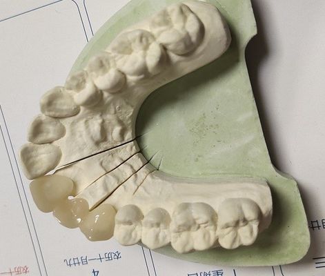 Couronne intérimaire de la technique ISO13485 de DAO