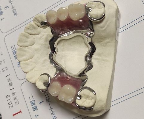 Cadre partiel en métal de dentier de la voûte Co d'alliage maxillaire de Cr