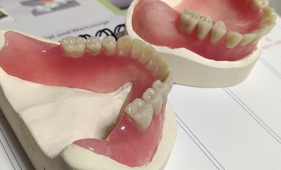 Dentier acrylique partiel inférieur esthétique démontable traité chaud