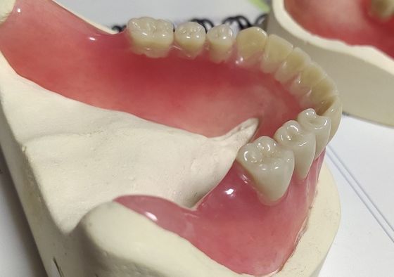 Dentier partiel acrylique traité froid de plein dentier d'esthétique