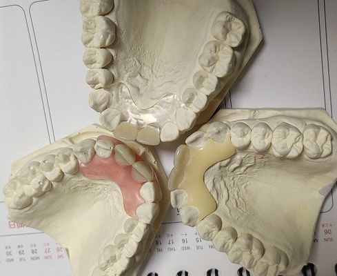 Dentier invisible mou et élastique provisoire de Valplast