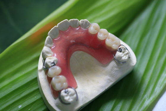 Dentier invisible flexible partiel pour les dents antérieures