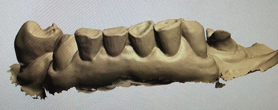 moquerie de 3D Digital vers le haut des dents d'autres produits dentaires