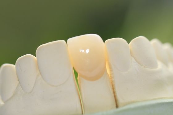 Couronne dentaire en céramique en verre permanent naturel pour les dents antérieures