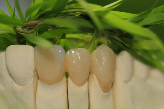 Les pleines étoiles de la couronne 5 d'oxyde de zirconium d'art dentaire prosthétique conçoivent le laboratoire dentaire