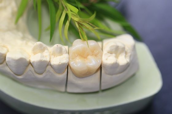 Couronne dentaire de zircone monolithique dentaire de laboratoire de conception pour les dents postérieures de molaires