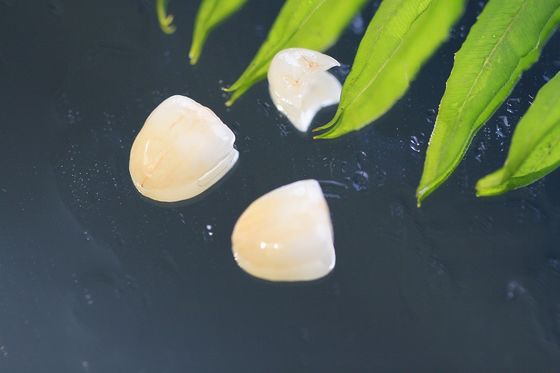 Couronne dentaire naturelle d'EMAX