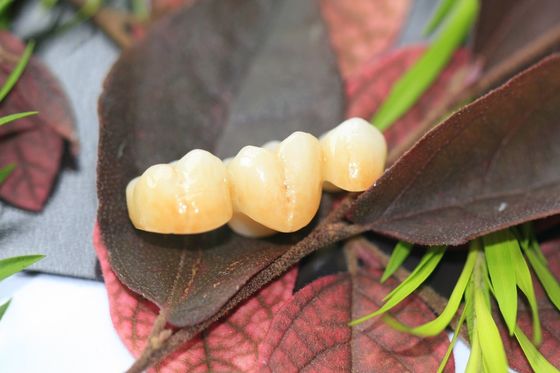 Couronne dentaire de zircone monolithique dentaire de laboratoire de conception pour les dents postérieures de molaires