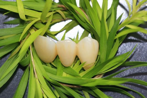 Couronne dentaire naturelle d'EMAX