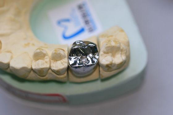 Le métal non précieux de pleine fonte allie la couronne dentaire