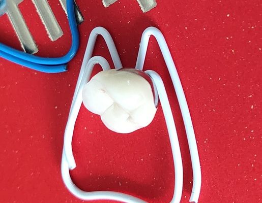 Couronne dentaire de la couronne 3D du laboratoire PFM de pont dentaire d'impression