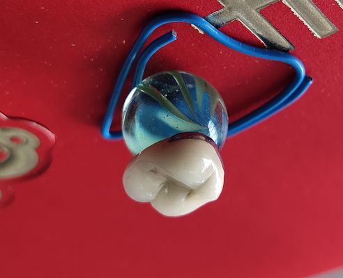 Porcelaine dentaire de couronne du DAO FAO PFM de produit de laboratoire fondue au métal