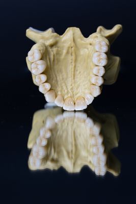 Esthétique dentaire d'étoiles de la couronne 5 de laboratoire de zircone dentaire de porcelaine