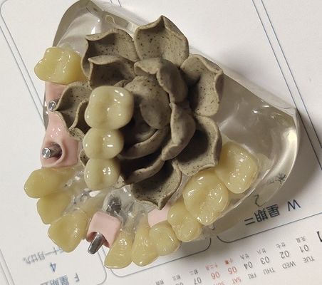 100 couronne provisoire de Biocompatibility PMMA de pour cent