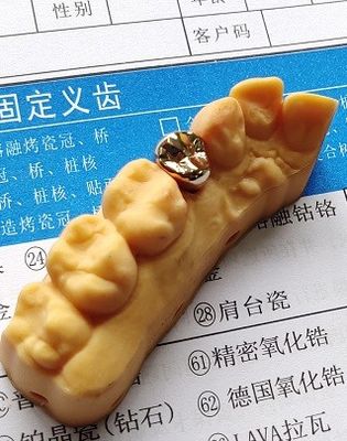 Haute couronne dentaire précieuse d'alliage d'or de bonne forme physique
